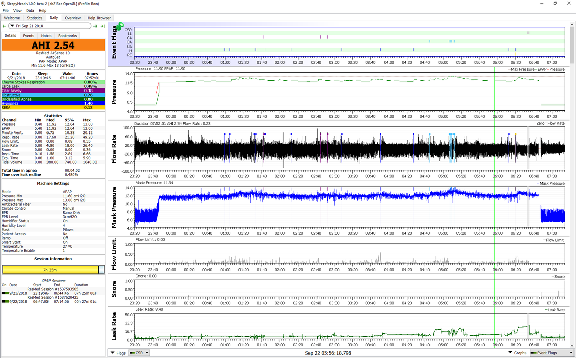 Resmed myAir Sleep Report MyApnea